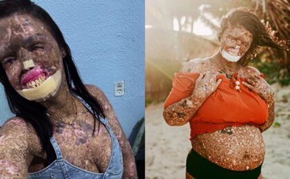 morre-kah-felipe,-influenciadora-que-convivia-com-doenca-rara-e-cancer-terminal