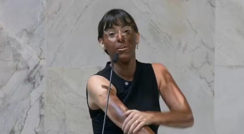 deputada-bolsonarista-que-fez-“blackface”-se-declara-parda